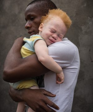 09 Jul 2013, Kinshasa, Democratic Republic of the Congo --- Democratic Republic of Congo (DRC), Kinshasa, black father holding his albino todler (Shango Okaka) in his smiling albino toddler in his arms against a grey wall, Kinshasa, (MR) --- Image by © Patricia Willocq/Art in All of Us/Corbis